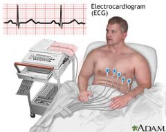 Diagnostic method to record the heart's electrical activity. Surface representation of myocardial depolarization and re-polarization.

12 lead ECG is standard, placed at different angles