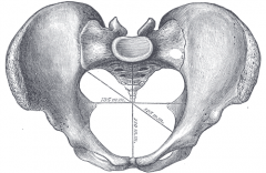 a planar surface which defines the boundary between the pelvic cavity and the abdominal cavity (or, according to some authors, between two parts of the pelvic cavity, called lesser pelvis and greater pelvis).
Its position and orientation relative to the 