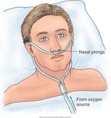 better tolerated and may be humidified but often not if run @ less than 5 L/min

The nasal cannula, or nasal prongs, is used at flow rates of 1 to 6 L/min. Approxi­mate oxygen concentrations of 24% (at 1 L/min) to 44% (at 6 L/min) can be achieved. Flow 