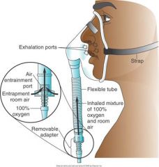 VENTURI MASK. The Venturi mask (commonly called Venti mask) delivers the most accurate oxygen concentration. Its operation is based on a mechanism that pulls in a specific pro­portional amount of room air for each liter flow of oxygen. An adaptor is locat