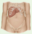 If you palpate a smooth, non-tender, large liver what would you consider as a possible diagnosis?


 


What if it is tender?