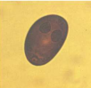 Hvilken type æg viser billedet?