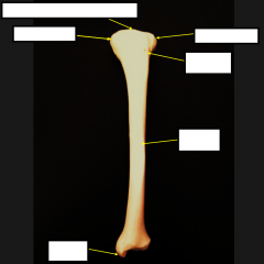 What bone is this and is it Left or Right?