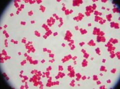       Identify
the Bacterial Morphology and gram stain 
