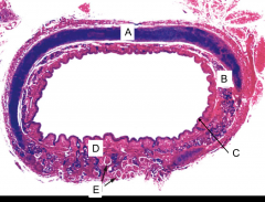 This is an image of the the trachea. What is A?