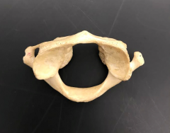 What bone is this?