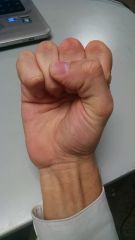 Thumb infont of fist.