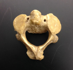 What bone is this?