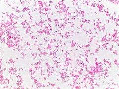 Gram +
- turns purple
Gram -
- turns pink
- considered more pathogenic
(pictured, E. coli)