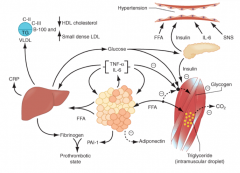 - The more adipose, the more FFAs
- FFAs result in increased production of glucose and TG
- FFAs also induce secretion of VLDL
- Reduced HDL and increased LDL