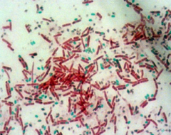 A. Structural 
B. endospores
C. Bacillus and Clostridium
D. vegetative, free spore, endospores 
