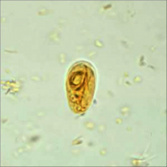 -Giardiasis (Giardia lamblia)

-prolonged diarrhea
-contaminated water
-person-person in day care centers
-MSM
-symptoms resolve spontaneously 4-6 weeks
-2 life-cycle stages - trophozoite (binds to epithelial cells, induces inflammation), d...