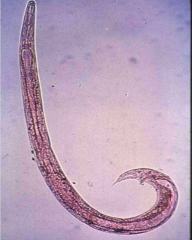 -hookworm

-small amount of blood per worm but overall loss is great