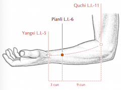 -3 c proximal to LI 5 (Yangxi)
-On the line connecting LI 5 with LI 11 (Quchi)
