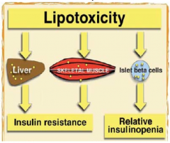 - Increased fatty acids from adipocytes leads to changes in post-insulin receptor function in muscle cells
- Decreases in IRS-1 function leads to a decrease in insulin-mediated glucose uptake, leading to hyperglycemia
- Lipotoxicity is also thou...