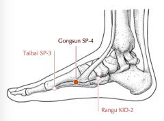 In the depression distal and inferior to the base of the 1st metatarsal bone