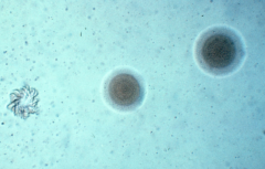 Atypical Cell Walls:
Mycoplasmas:
A. Lack ___ _____
B. ______ in plasma membrane