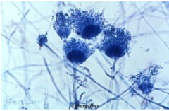 (brugt til alger)
- Fenol: dræber levende organismer.
- Mælkesyre: bevarer de fungale strukturer
- Cotton blue: farver kitin i svampenes cellevægge.