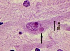 Rhabdoviruses replicate in the CYTOPLASM of the host cell and their inclusion bodies are called NEGRI BODIES.