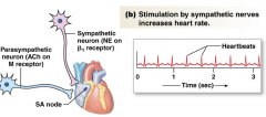 Parasympathetic stimulation hyperpolarizes the


membrane potential of the autorhythmic cell and


slows depolarization, slowing down the heart rate