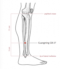 - 5 c superior to the prominence of the lateral malleolus
- anterior border of the fibula