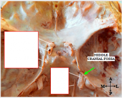 ID the nerves and vessels shown here. 
 
Which CN is the internal carotid inferior to?