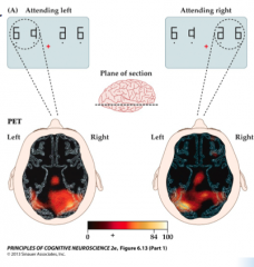 More fMRI activation in right visual cortex when attending to the _____


 


More fMRI activation in left visual cortex when attending to the _____