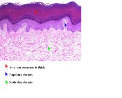 Normal Skin histology

Learn the layers of the Epidermis