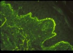 Immunofluorescence highlights IgG