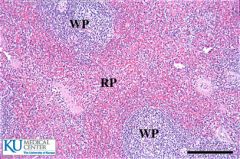 Red Pulp: BV mainly (hence red)

White pulp (actually blue): site of B and T cells