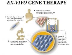 Cells isolated, therapeutic gene introduced. Genetically engineered cells = propagated & returned/injected.