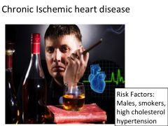 a.	progressive onset of CHF over years dt chronic ischemic myocardial damage
b.	Inc. Risks: Smokers, High Cholesterol, DM, HTN -usually males. 
c.	Can present itself as a long-standing Unstable Angina Pectoris. 
d.	Dx: ECG, Blood markers, cardiac stres