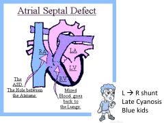 a.	The R ventricle will fill during diastole ^ R ventricular volume. → ^ blood on the R → causes a wide fixed split  S2
b.	L → R shunt, → pulm HTN → late cyanosis  → blue kids