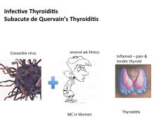 a.	aka Subacute (deQuervain, granulomatous) thyroiditis
b.	caused by viral infection : MC coxsackie or mumps
c.	Follows a self-limited course of several wks duration flu-like illness /c pain & tenderness around the thyroid
d.	More common in Women
e.	A