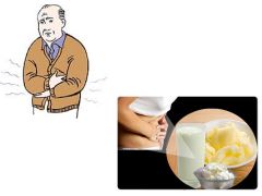 a.	Inability to digest lactose 
b.	Sx: abdominal cramps and diarrhea