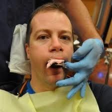 What is the primary purpose of taking a dental impression?
