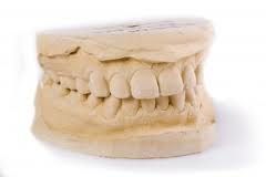 Positive replica of teeth and tissues.