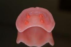 material used to adhere a denture to the oral mucosa