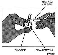 An amalgam well