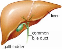 Gallstones: Goroll page 549
Pathophysiology 
Risk factors 
Biliary sludge