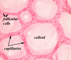 Thyroid epithelial cells
(or "follicular cells")
Follicles