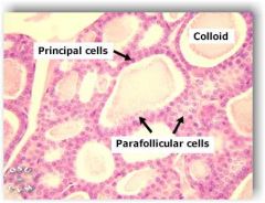 The follicles are surrounded by a single layer of thyroid epithelial cells,
•	Which secrete T3 and T4.
•	 When the gland is not secreting T3 and T4 (inactive), the epithelial cells range from low columnar to cuboidal cells. 
•	When active...