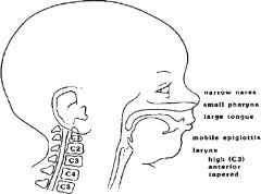 Neonatal airway
- large head / occiput (need for neutral position for intubation/ventilation)
- narrow nasal passages (nose easily obstructed, obligate nasal breathing can cause resp distress)
- large tongue (potential obstruction, and difficult laryng
