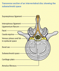 (2012-A) Question 12 a. Describe the anatomy of the epidural space (50%) b. What are the clinical implications of the anatomical differences between thoracic and lumbar epidural spaces in the placement and management of epidural analgesia? (50%)