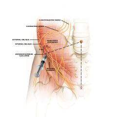Inguinal regions supplied by:
­	Iliohypogastric nerve – from L1
•	Supplies skin over the inguinal region
­	Ilioinguinal nerve – from L1
•	Supplies skin on the superomedial aspect of the thigh
­	Genitofemoral nerve – from L1 and L2
•	Genital branch: 