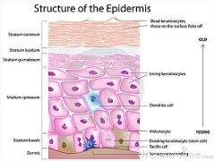 Avascular, stratified squamous epithelium that consists of 5 separate layers