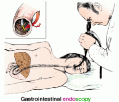 visually examining the stomach by inserting a gastroscope into the mouth and eased down the esophagus into the stomach (see illustration).