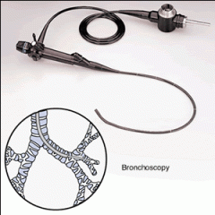 a visual examination of the bronchial tubes with a fiberoptic or rigid endoscope—can be used to identify the source of secretions.