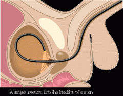 visual examination of the urinary bladder (cyst/o) using a specialized type of endoscope called a cystoscope.