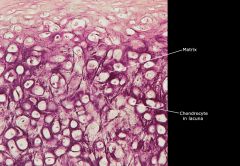 cartilage cell